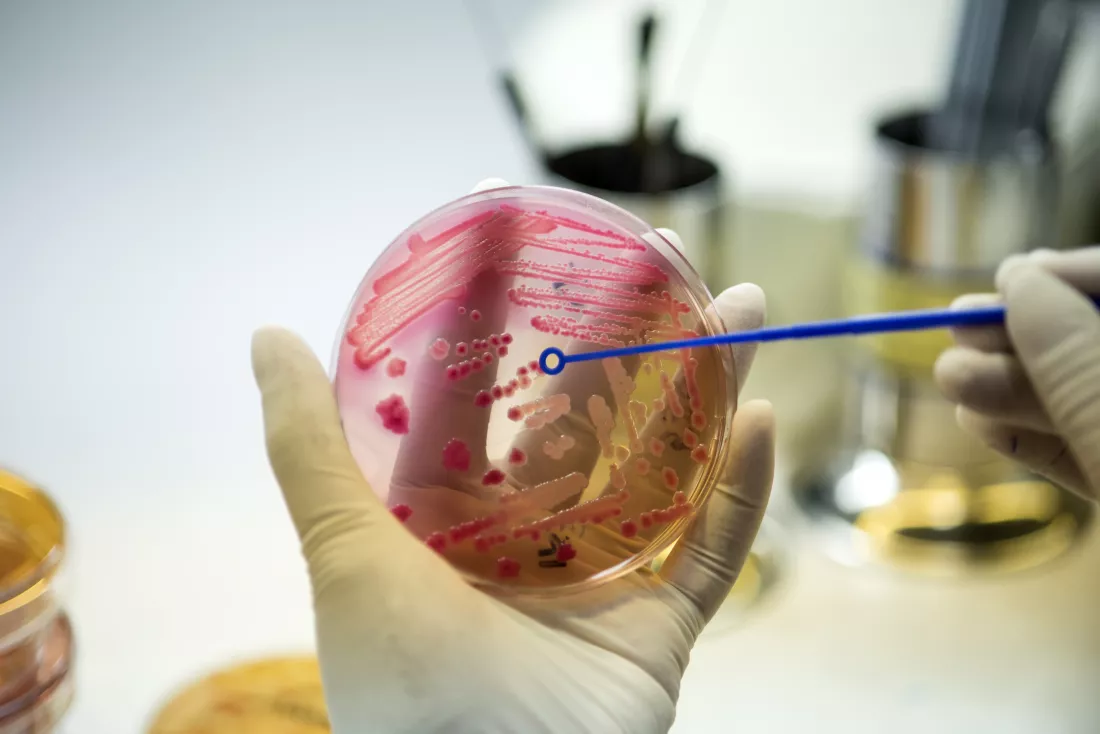 Mikrobiologia z biotechnologiąv